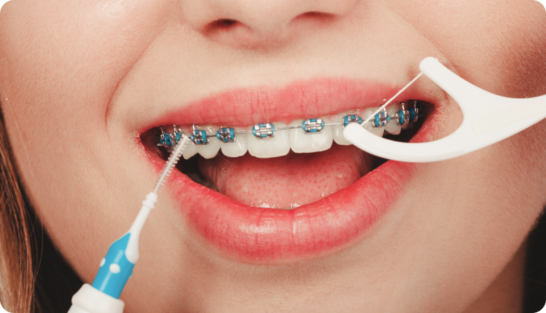Hygiène bucco-dentaire Orthodontie à La Roche-sur-Foron, Dr Baillet, Artalign