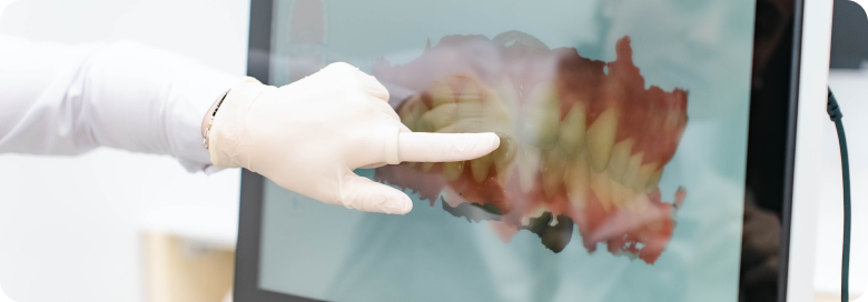 Notre cabinet Orthodontie à La Roche-sur-Foron, Dr Baillet, Artalign